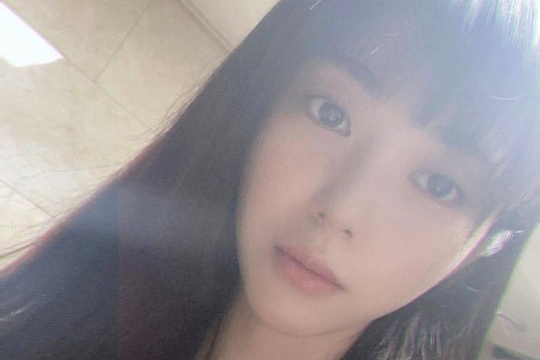 권민아, 악플에 또 극단적 선택 시도 "너희 한마디에 나는 이렇게 푼다" | 인스티즈