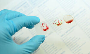 희귀 혈액형 p형을 아시나요?