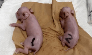 '인체 장기 이식용' 유전자 조작 돼지 첫 탄생