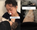 &${esc.h}34;며칠째 죽어가는 중&${esc.h}34;…이영지, 안타까운 근황