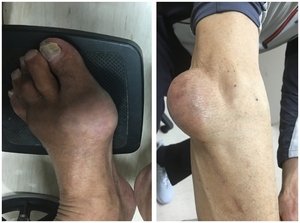 출산보다 고통스러운 ‘이 병’