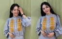 장영란, 4번째 눈성형 후 근황…몰라보게 예뻐져