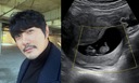 KCM, 세 아이 아빠된다…초음파 사진 공개