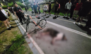 전기자전거에 끌려가다 죽은 개…사건의 진상은