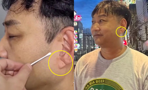 ‘촬영 중 실신’ 김수용, 전조증상 포착?…“귓볼에 ‘이것 ’심혈관 질환 징후”