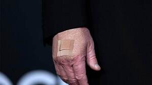 트럼프 이번엔 오른손등에 며칠째 반창고…백악관 “악수 탓”