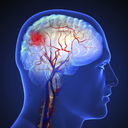 “갑자기 말이 어눌해진다면”… 한파 속 ‘뇌졸중’ 골든타임 4시간 30분