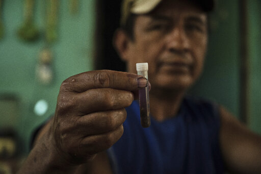 2025년 7월 23일(현지시간) 멕시코 치아파스주 신탈라파의 한 목장에서 이곳 직원이 소에서 제거한 '신세계 나사벌레'를 시험관에 넣어 보여 주고 있다. 미국은 이 해충이 국경까지 확산하는 것을 우려해 멕시코산 소 수입을 중단했으며, '살 파먹는' 나사벌레 퇴치를 위해 방사선으로 불임 처리한 수컷 파리를 멕시코와 텍사스 상공에 살포할 계획이다.