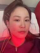 김지민, 욕실 낙상사고 후 &${esc.h}34;볼 함몰돼 보조개 생겨…침 맞으며 노력&${esc.h}34;