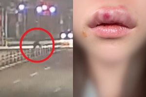 “배달원인데요?” 20대 전여친 원룸 찾은 10대…흉기난동 3명 중경상