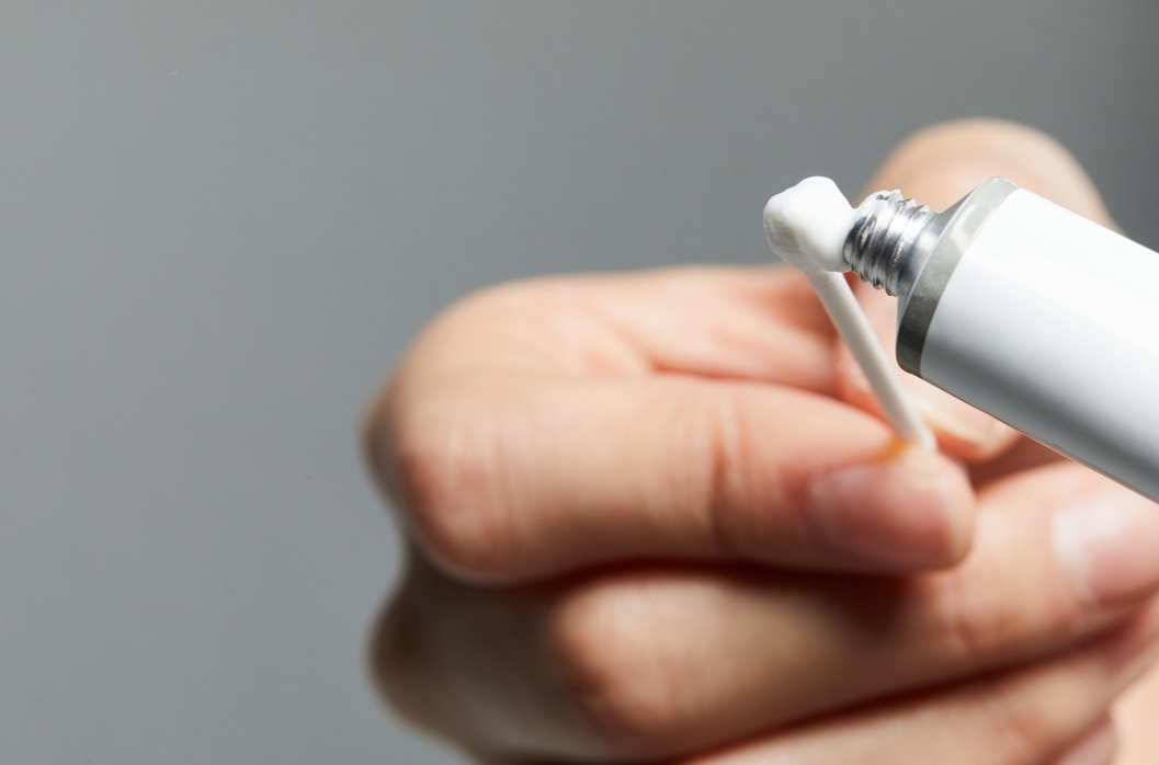 면봉에 연고를 묻혀 사용하는 모습. 손가락 대신 멸균 면봉을 사용하면 필요한 만큼만 덜어 위생적으로 바를 수 있다. 사진=게티이미지뱅크