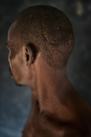 [한 컷의 울림] ‘버려진 위기’… 수단 내전이 남긴 흉터