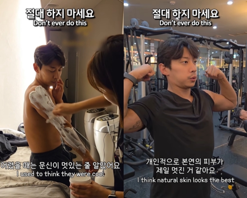 곽윤기가 문신 제거 시술 모습을 공개하며 “절대 하지 말라”고 당부했다. 사진=곽윤기 SNS 캡처