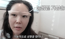 장영란 &${esc.h}34;눈썹 밑 거상 후 자신감 생기고 너무 행복해&${esc.h}34;
