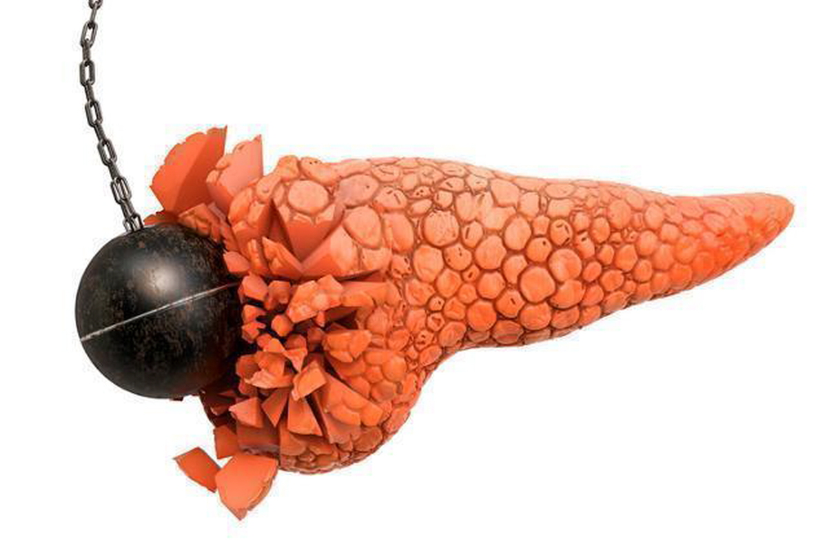 “검진 정상 믿었는데”…생존율 17% ‘침묵의 암’ 키우는 3가지 습관