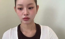 맹승지 &${esc.h}34;인중 길어 늘 신경 쓰였다&${esc.h}34; 수술 후 모습 공개