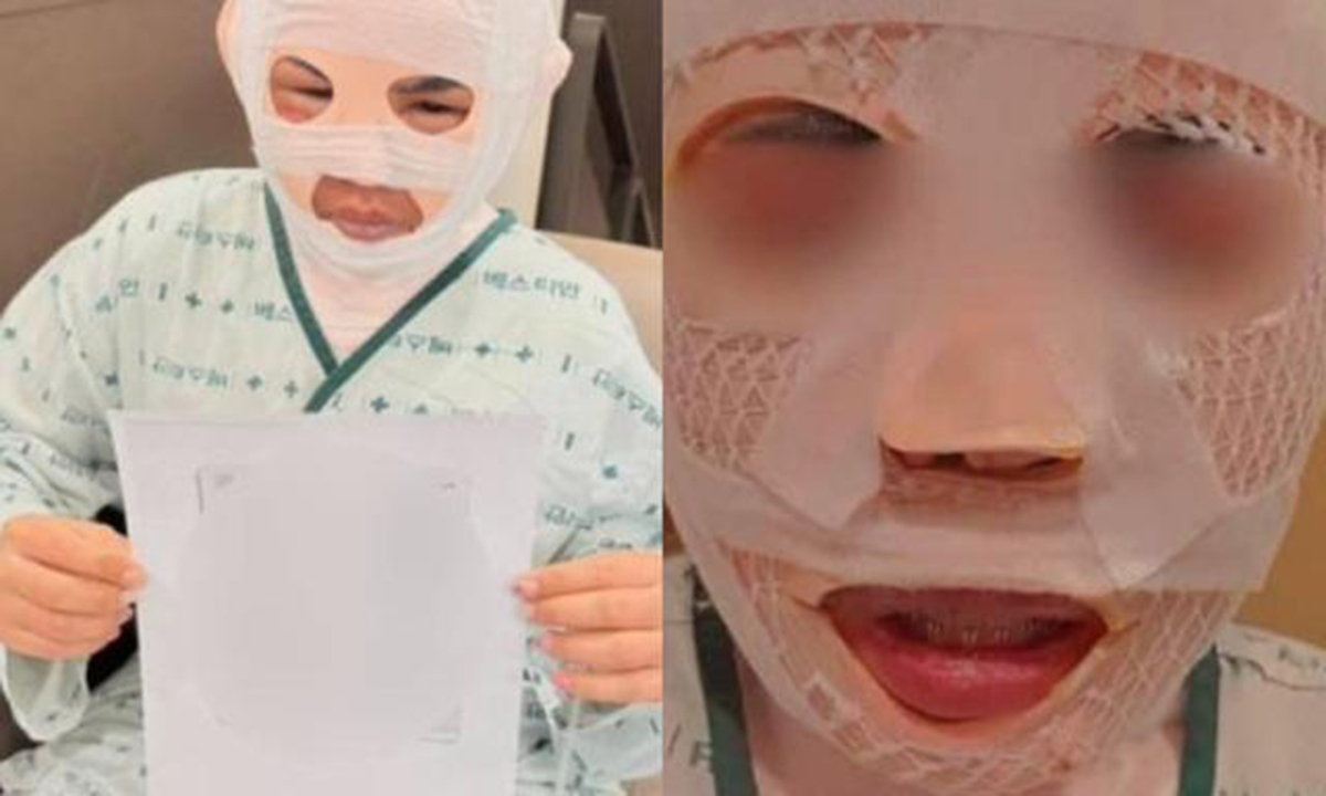 잠든 아내 얼굴에 끓는 물 부은 남편, 2심서 감형… 아내 측 “못생기게 만들고 싶다고 해”